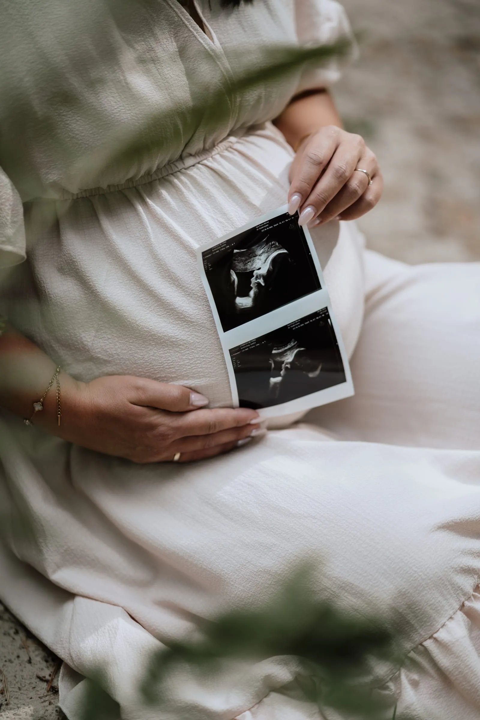 Das Ultraschallbild liegt auf dem Babybauch im weißen Kleid